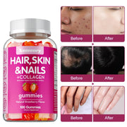 Biotin Gummies - High Potency Gluten Free Hair Skin Nails - nutriamazonia