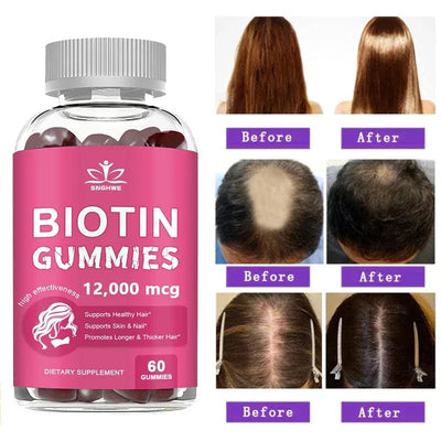 Collagen Biotin Gummies - Supports Radiant Skin, Hair And Nails Nutriamazonia Adults Glow - nutriamazonia