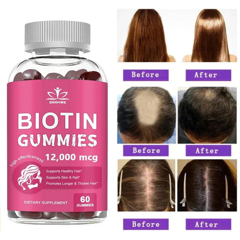 Collagen Biotin Gummies - Supports Radiant Skin, Hair And Nails Nutriamazonia Adults Glow - nutriamazonia